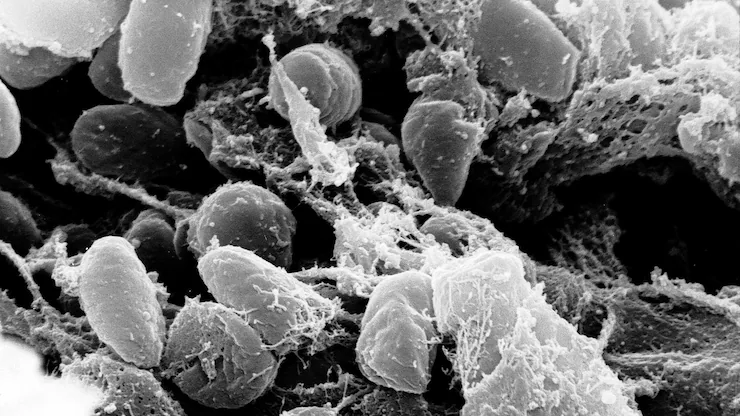 鼠疫耶尔森氏菌(Yersinia pestis)。