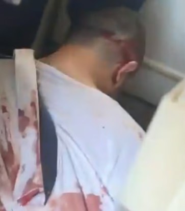 杜拜航空客机恐袭未遂案:以色列传媒曝光副机师遭制服后的照片(影片截图)