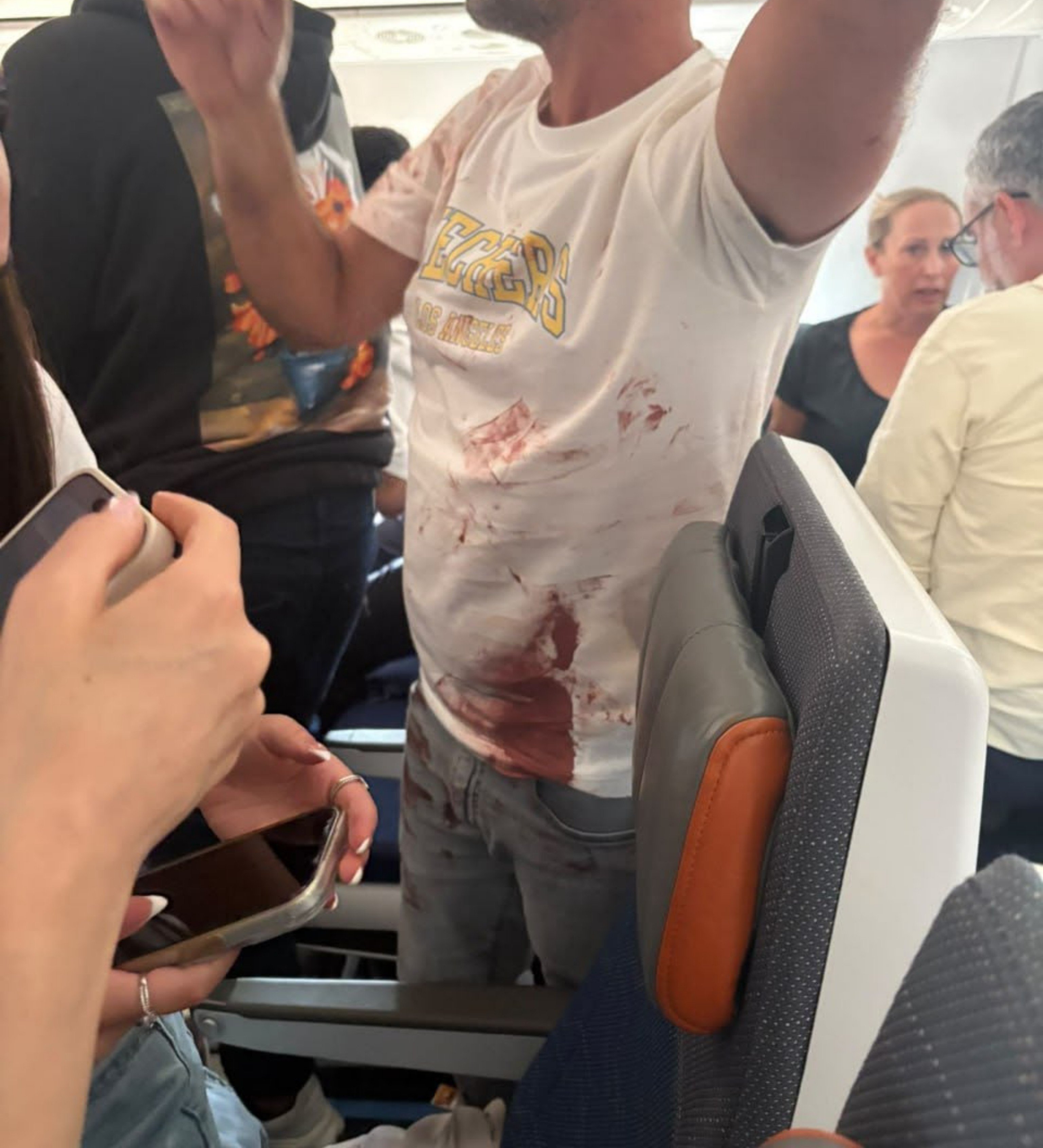这张由以色列媒体发布的画面显示，9月30日，在一架从阿联酋迪拜飞往以色列特拉维夫的客机上，一名乘客身上沾有血迹。新华社发